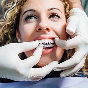 Patient being fitted with a clear Invisalign aligner at a dental clinic in Ann Arbor MI