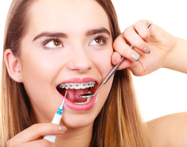 How to keep your braces clean?- treatment at comfortsmiles in Ann Arbor  