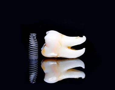 Zygomatic implants- treatment at comfortsmiles in Ann Arbor  