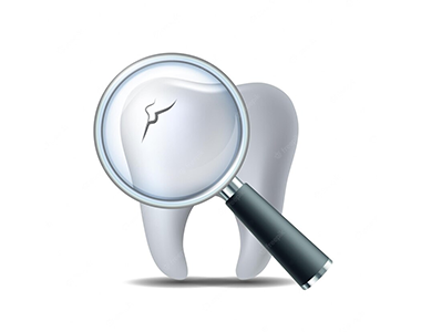 Cracked tooth- treatment at comfortsmiles in Ann Arbor  