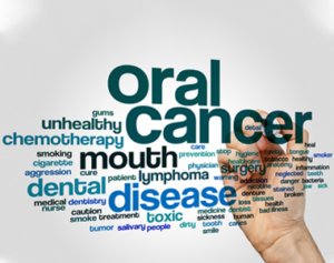 Early Detection and Prevention of Oral Cancer