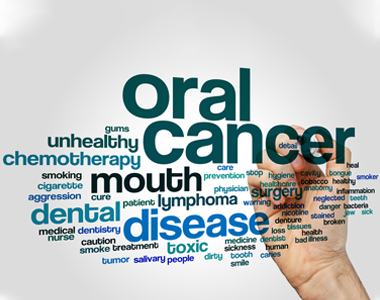 Oral cancer- treatment at comfortsmiles in Ann Arbor  