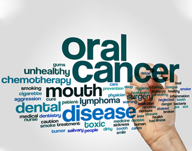 Oral Cancer- treatment at comfortsmiles in Ann Arbor  