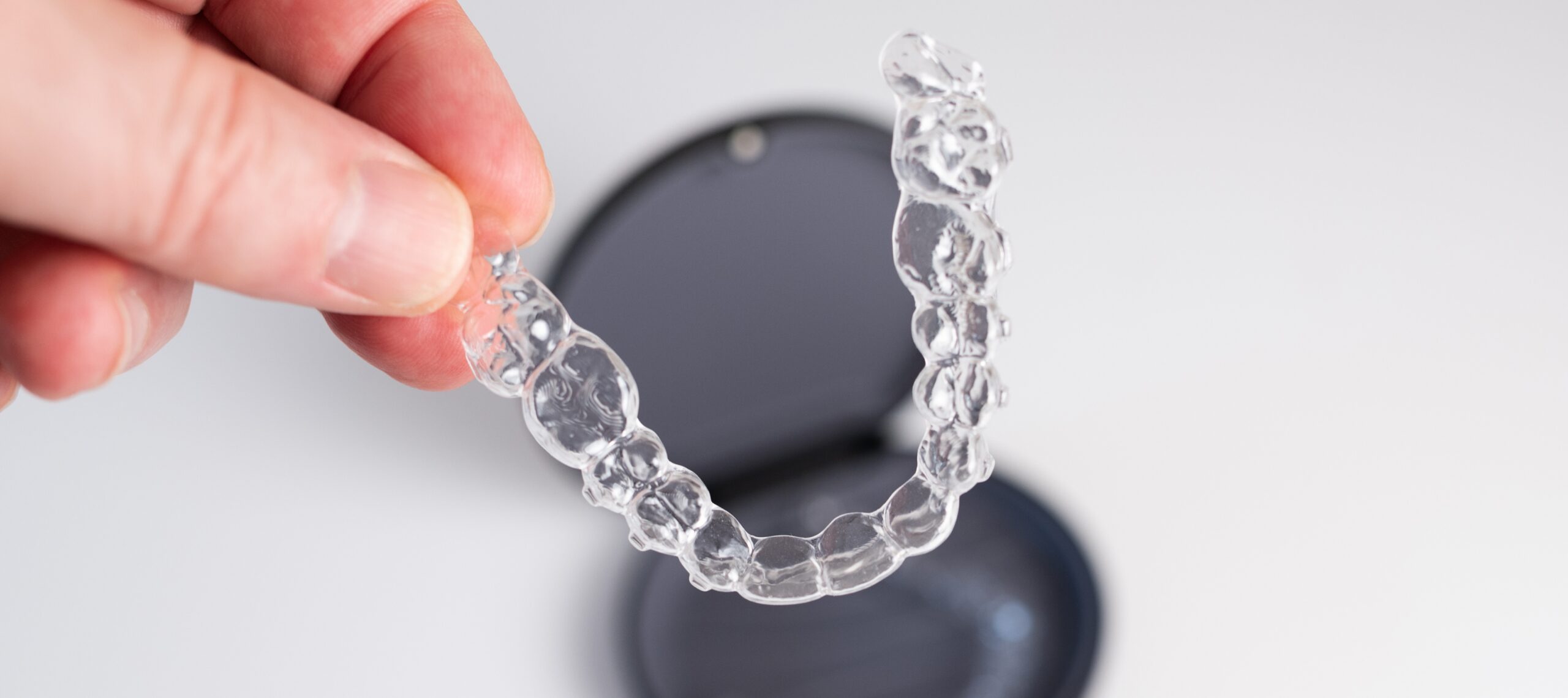 Invisalign service