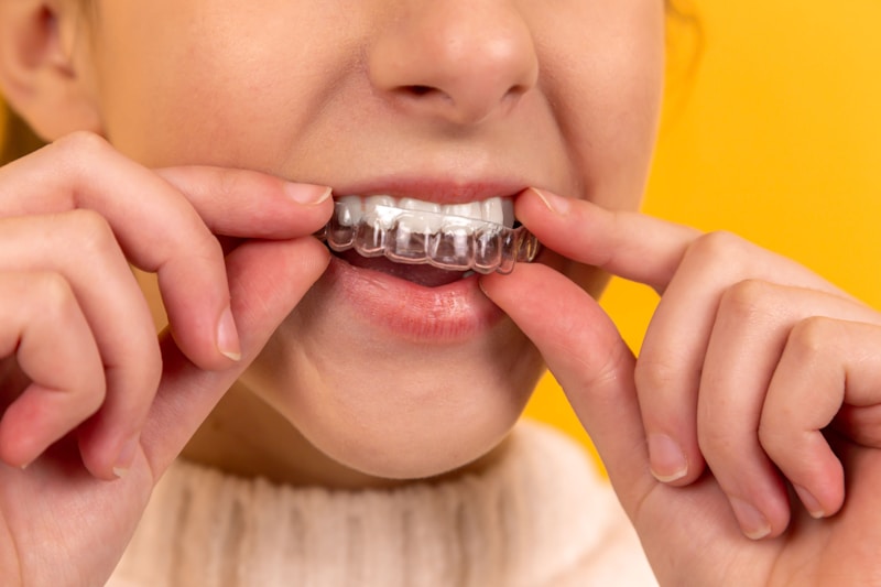 Invisalign clear aligner trays used for straightening teeth in Ann Arbor