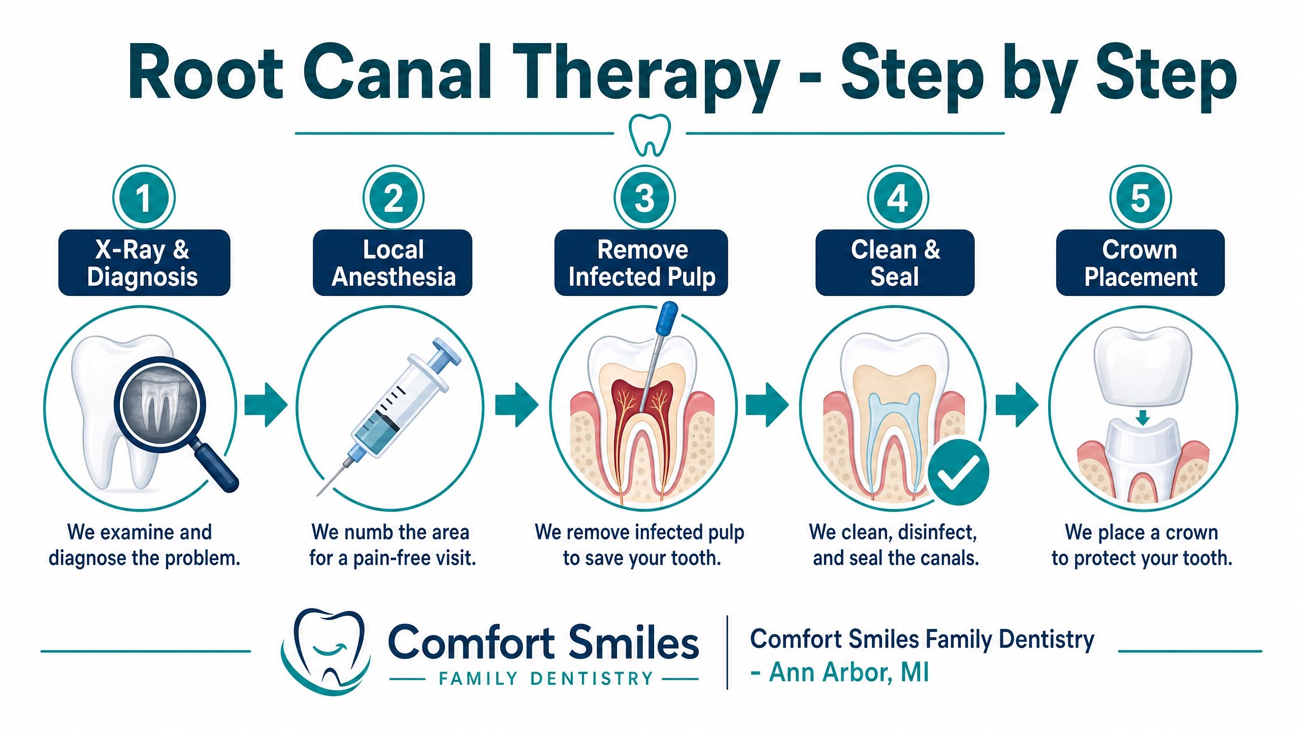 Infographic showing root canal therapy process step by step at Comfort Smiles Ann Arbor MI
