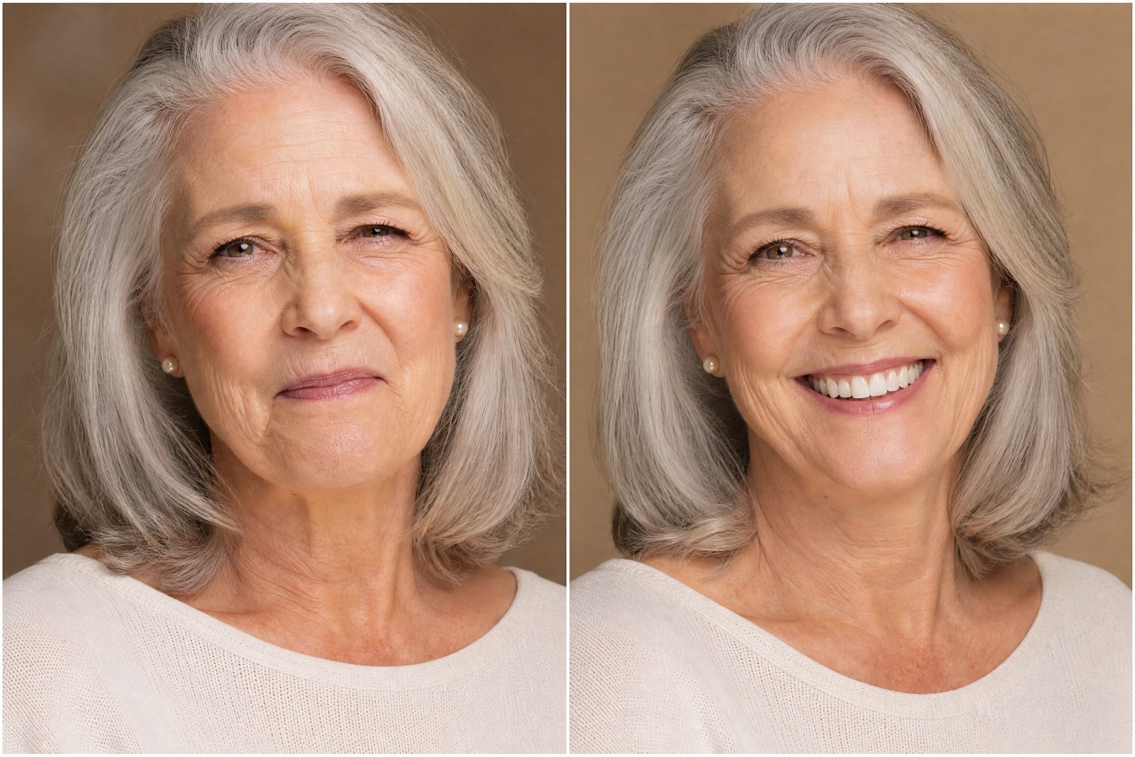 Before and after dentures transformation at Comfort Smiles Ann Arbor