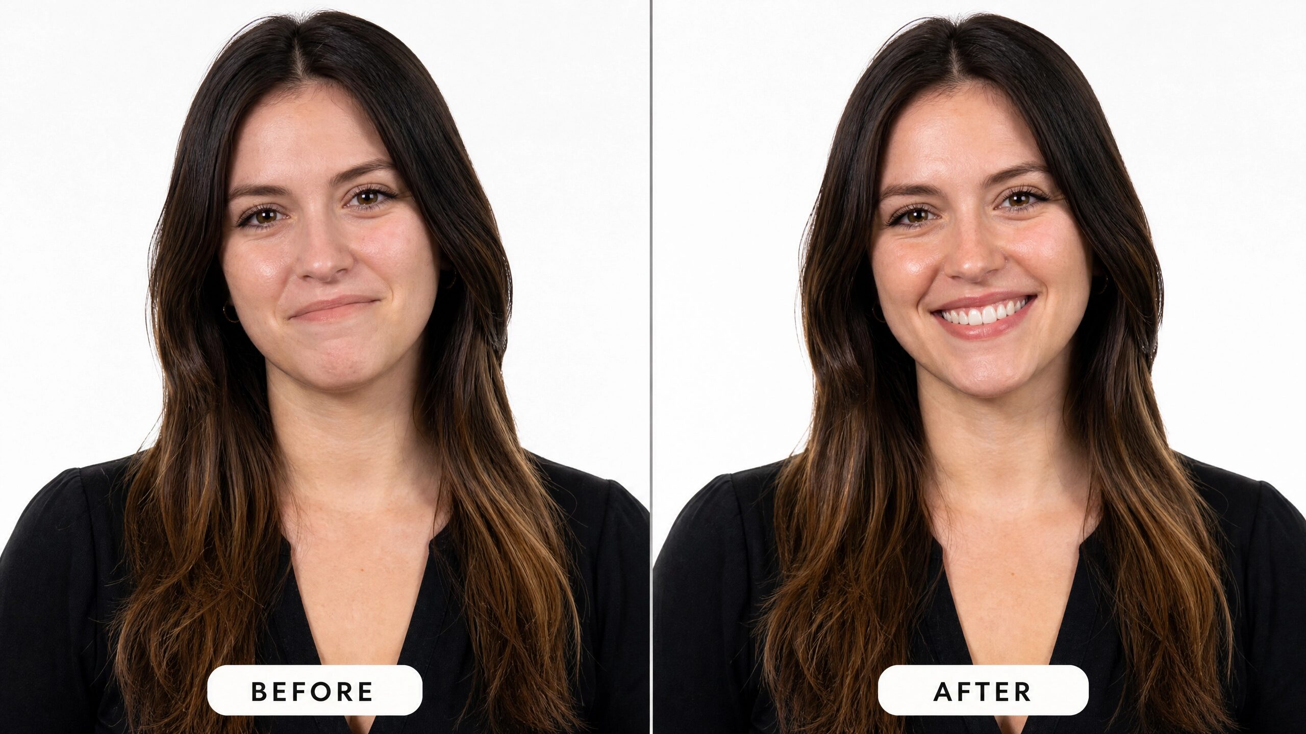Before and after tooth-colored filling results at Comfort Smiles Ann Arbor